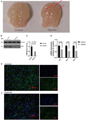 Intranasal IL-4 Administration Alleviates Functional Deficits of Periventricular Leukomalacia in Neonatal Mice